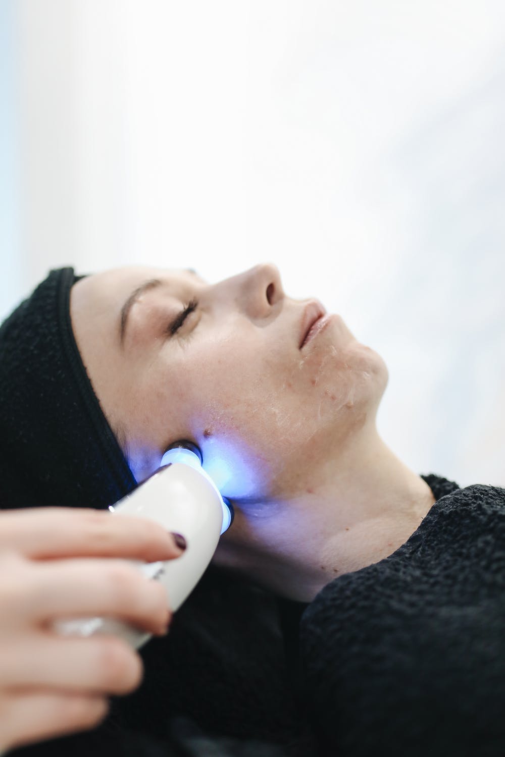 beauty, laser hair removal